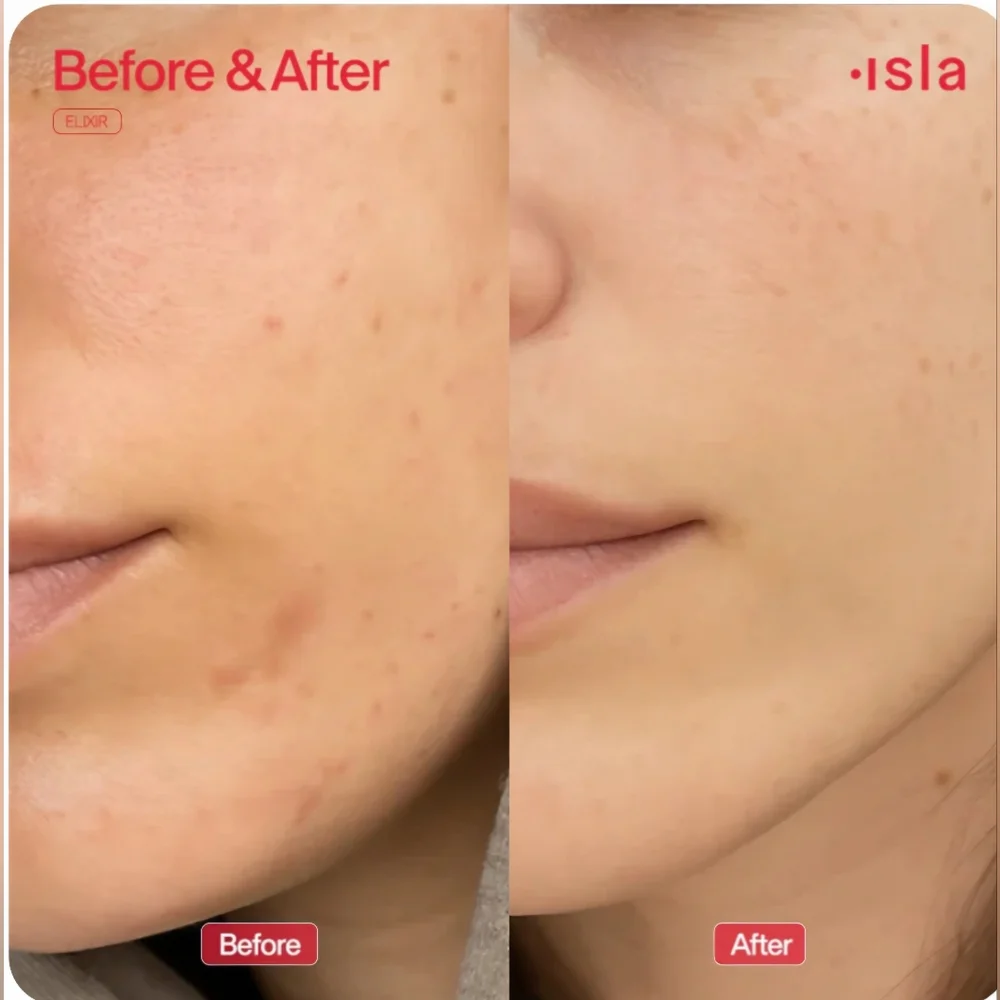 ISLA!! The Elixir Hydrating Serum- LISTING IS FOR ONE!! - Picture 6 of 14